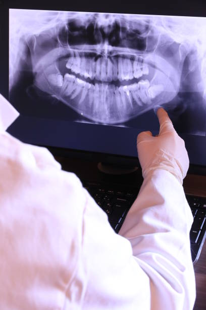 Best Emergency Dentist for Knocked-Out Tooth in North Ballston Spa, NY